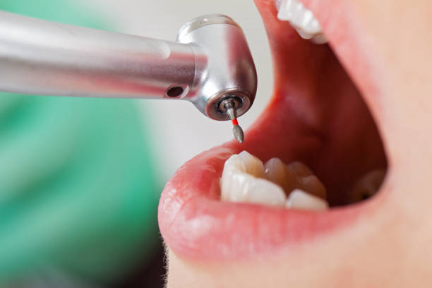 Best Same-Day Emergency Dental Services in Ddanelle, AR